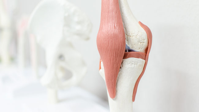 Fäden ziehen nach knie arthroskopie